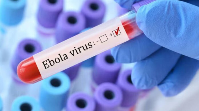 ebola-virus